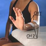Стимуляция руки после инсульта thumbnail